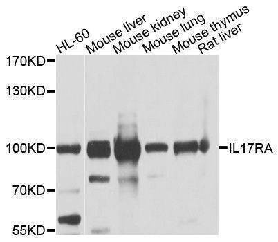 Anti-IL17RA Antibody