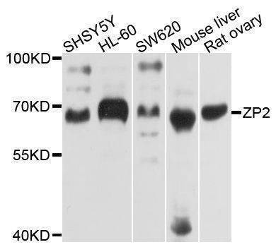 Anti-ZP2 Antibody