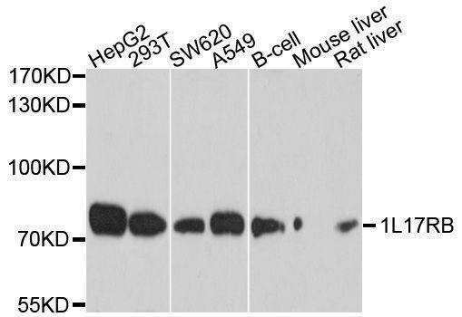 Anti-IL17RB Antibody