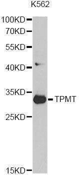 Anti-TPMT Antibody