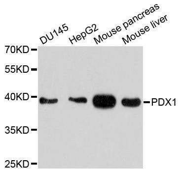 Anti-PDX1 Antibody