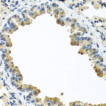 Anti-SERPINA3 Antibody