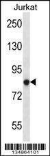 Anti-Prkca (N-term) Antibody
