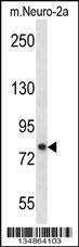 Anti-Prkca (N-term) Antibody