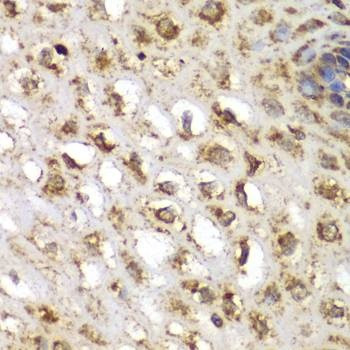Anti-SGK1 Antibody