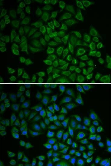 Anti-SGK1 Antibody