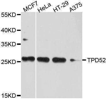 Anti-TPD52 Antibody