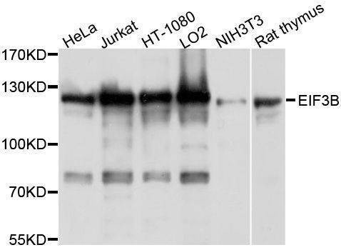 Anti-EIF3B Antibody