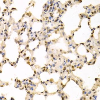 Anti-SFN Antibody