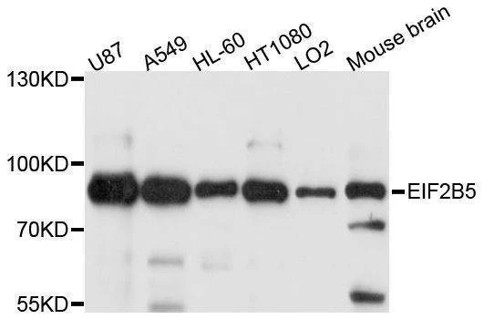 Anti-EIF2B5 Antibody