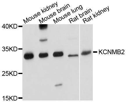 Anti-Mouse/Rat KCNMB2 Antibody