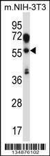 Anti-TEAD2 (Center) Antibody