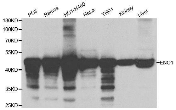 Anti-ENO1 Antibody
