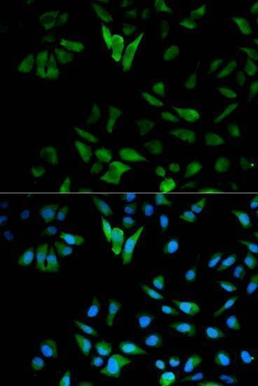 Anti-ENO1 Antibody
