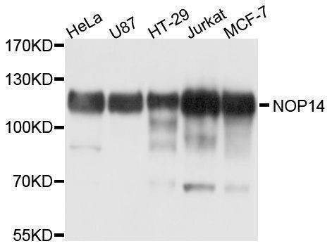 Anti-NOP14 Antibody