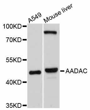 Anti-AADAC Antibody