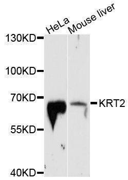 Anti-KRT2 Antibody