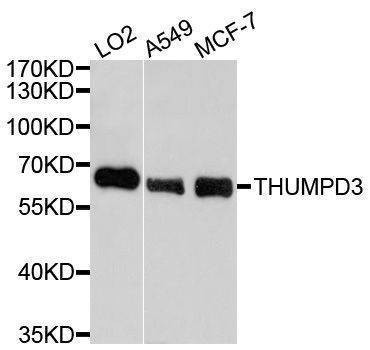 Anti-THUMPD3 Antibody