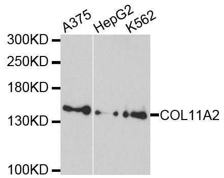 Anti-COL11A2 Antibody