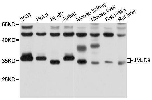 Anti-JMJD8 Antibody