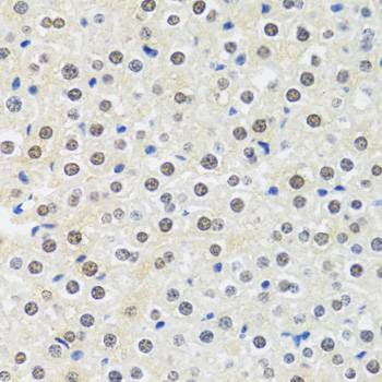Anti-MTAP Antibody