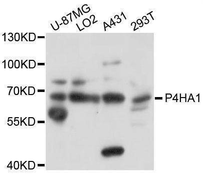 Anti-P4HA1 Antibody