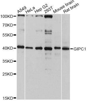Anti-GIPC1 Antibody