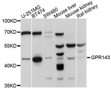Anti-GPR143 Antibody