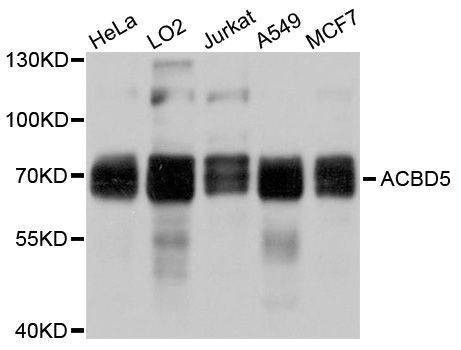 Anti-ACBD5 Antibody