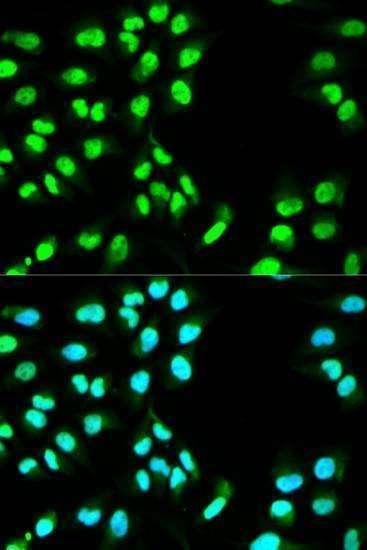 Anti-MCM3 Antibody