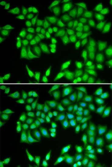 Anti-MCM3 Antibody