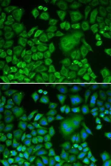 Anti-ACTR3 Antibody