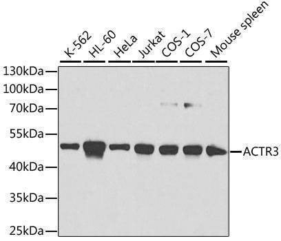 Anti-ACTR3 Antibody