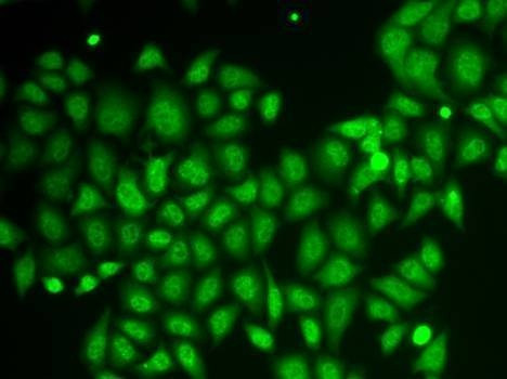 Anti-AKR1A1 Antibody