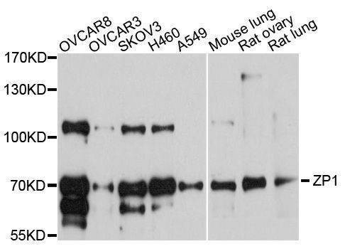 Anti-ZP1 Antibody