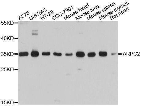 Anti-ARPC2 Antibody