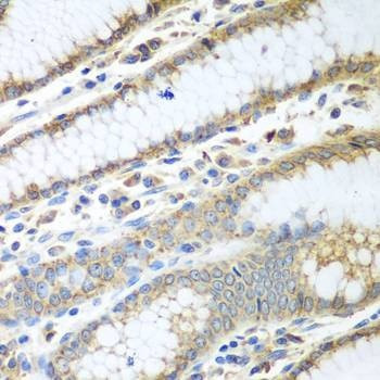 Anti-PDIA3 Antibody