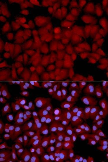 Anti-PPP1CB Antibody