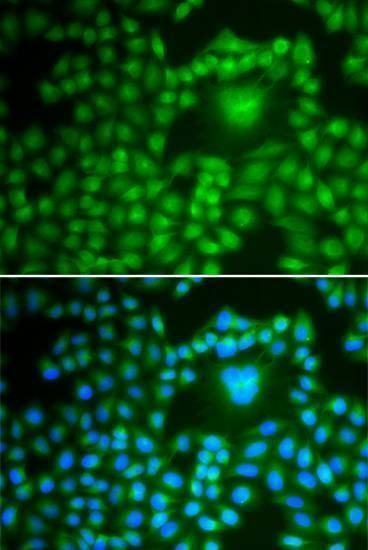Anti-PPP1CB Antibody