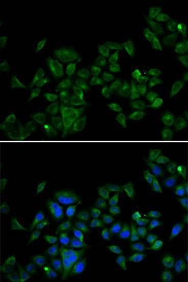 Anti-MAGED1 Antibody