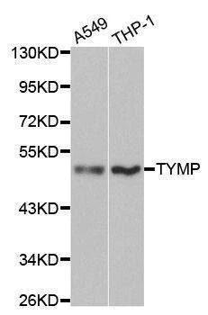 Anti-TYMP Antibody