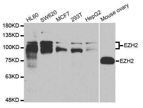 Anti-EZH2 Antibody
