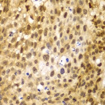 Anti-IRF3 Antibody