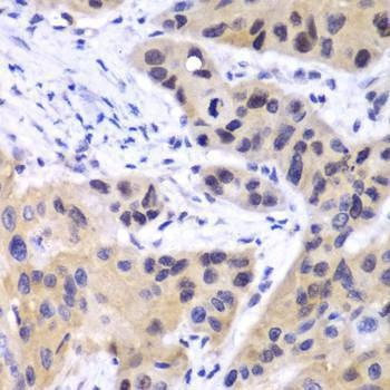 Anti-IRF3 Antibody