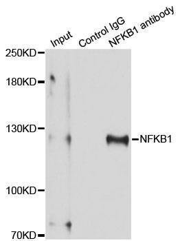 Anti-NFKB1 Antibody