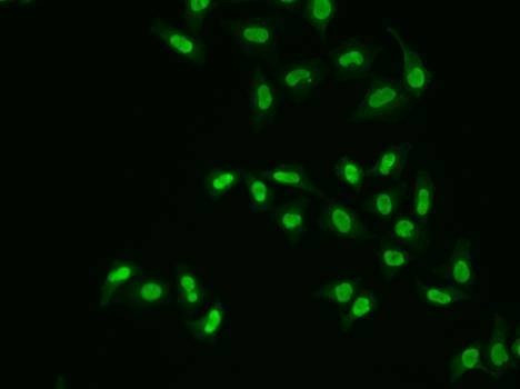 Anti-APEX1 Antibody