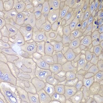 Anti-ANXA1 Antibody