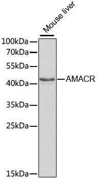 Anti-AMACR Antibody
