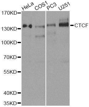 Anti-CTCF Antibody