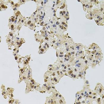 Anti-EGFR Antibody